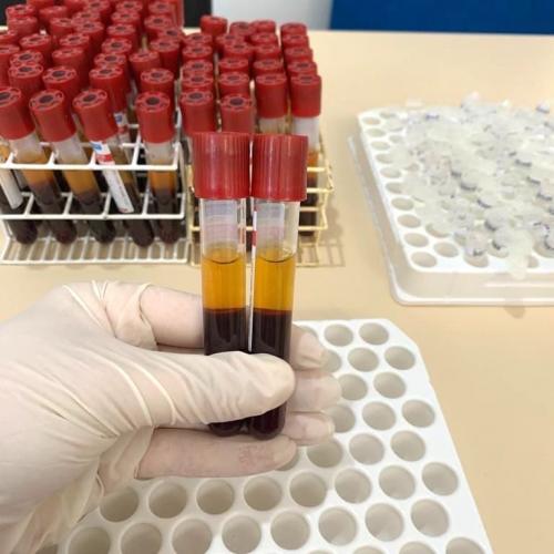 Pesquisa pretende prever possíveis pandemias provocadas pela relação do homem com os animais . Foto: Adapa